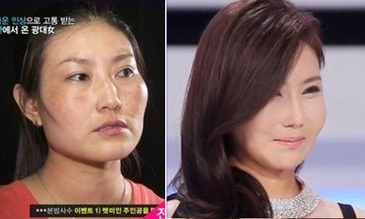 韩国每天造6000美女 揭秘整容前后对比照